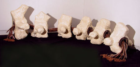 Vertebrae